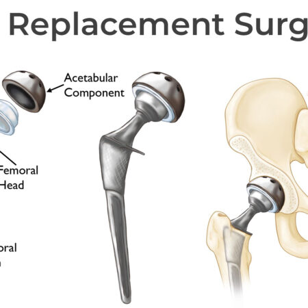 Senators` Nick Jensen undergoes hip surgery, GM says no timeline for return